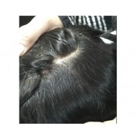 HD Thin Magic hair patch